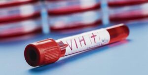 tubo de sangre para prueba de vih