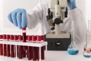 tubos de muestras de sangre