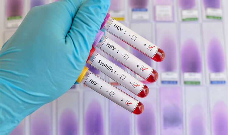 tubos de sangre para pruebas ets