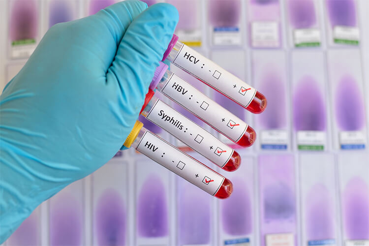 tubos de sangre para pruebas ets