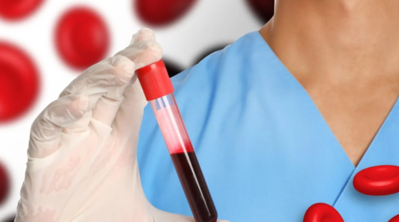 personal de la salud con tubo de sangre para prueba de anemia