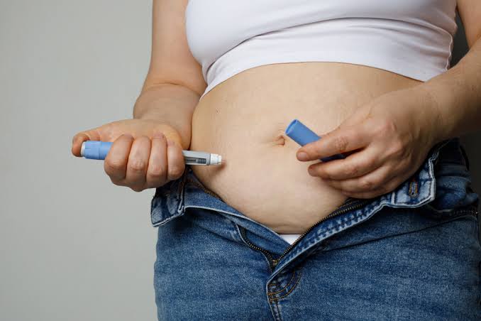 Obesidad y tratamiento GLP 1